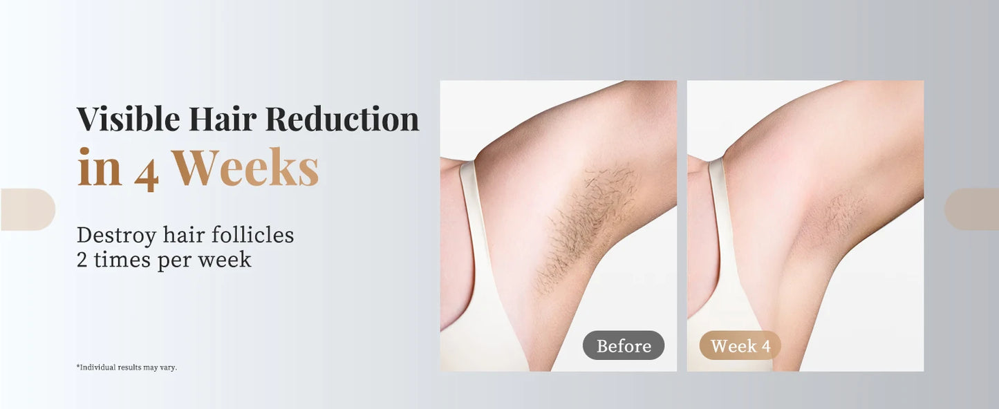 3-in-1 Laser Epilator 999900 Flash Painless IPL Hair Removal for Women Bikini Legs Arms Laser Hair Remover Permanent Depilato