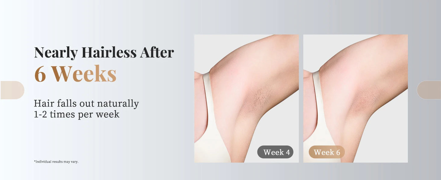 3-in-1 Laser Epilator 999900 Flash Painless IPL Hair Removal for Women Bikini Legs Arms Laser Hair Remover Permanent Depilato